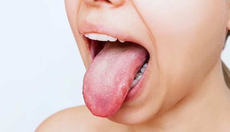 What color is your tongue