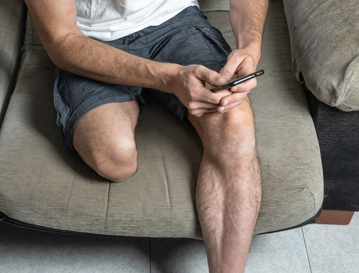 همه چیز درباره پای مصنوعی ژله ای (ویژگی ها + قیمت)